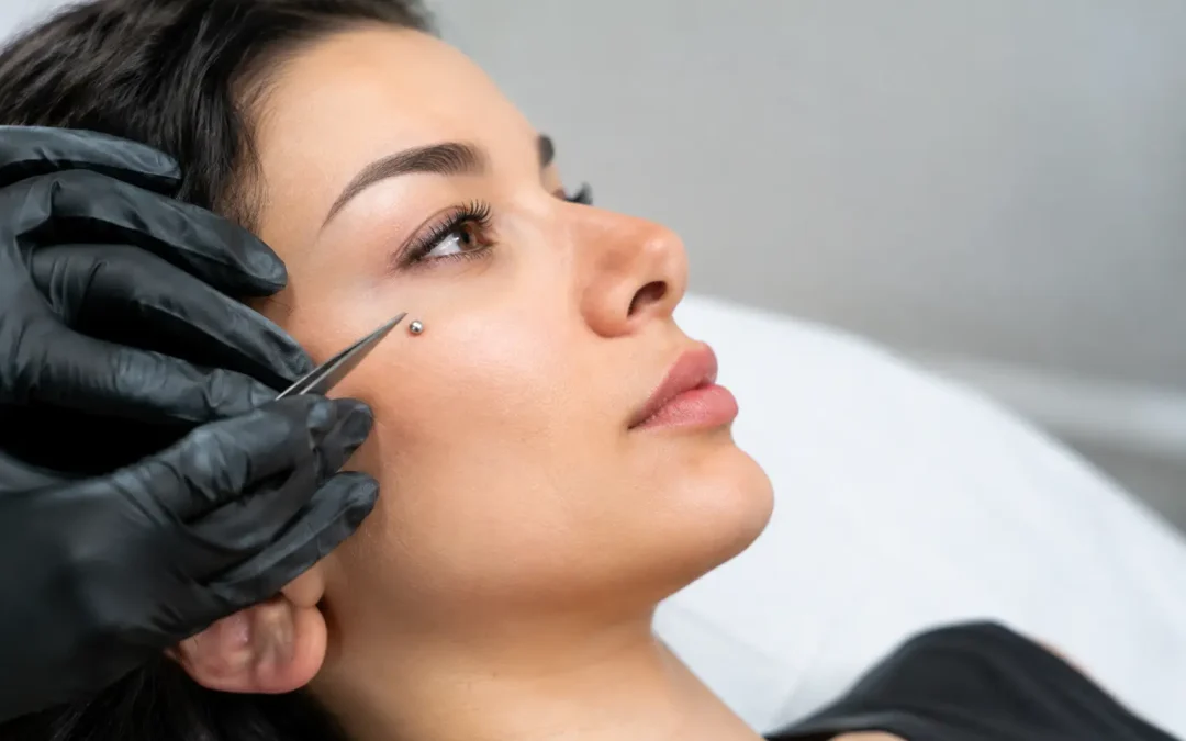 Een microdermal piercing laten zetten: zo werkt het